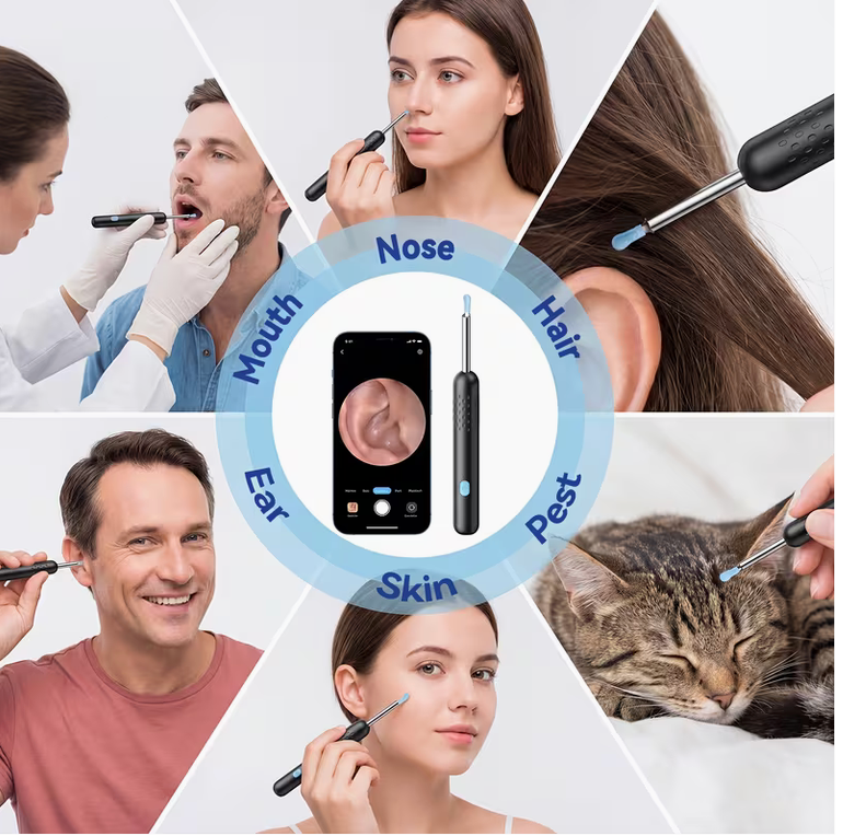 Wireless Ear Wax Removal Tool with 1080P HD Camera & 8-Piece Set